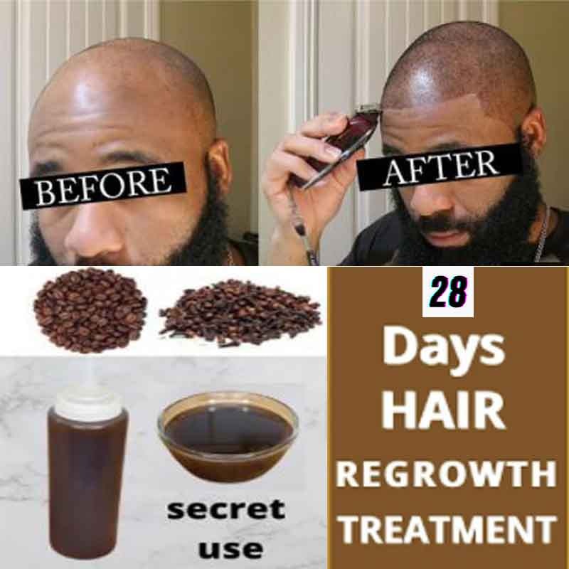 300ml Combining  Africa Chad Chebe Powder Local Ingredients with Modern Craftsmanship 2 Month Super Fast Hair Growth Shampoo